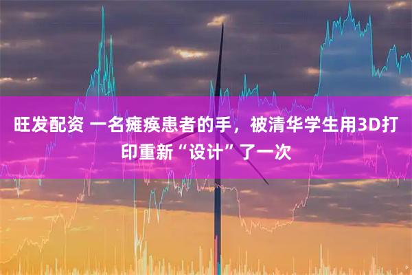 旺发配资 一名瘫痪患者的手，被清华学生用3D打印重新“设计”了一次