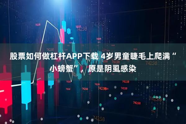 股票如何做杠杆APP下载 4岁男童睫毛上爬满“小螃蟹”，原是阴虱感染